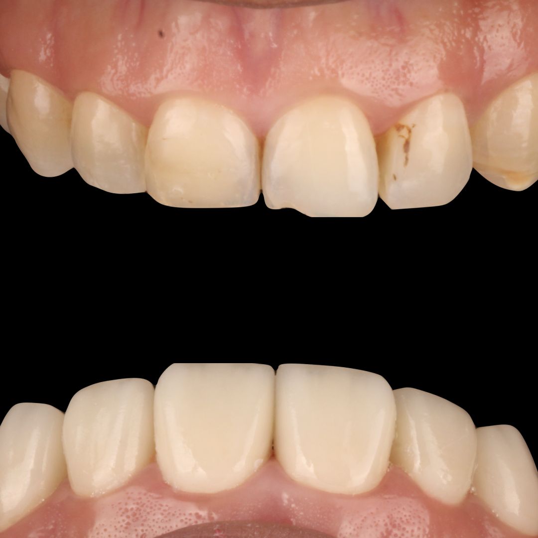 Miguel Alberto Escalona Mora-6