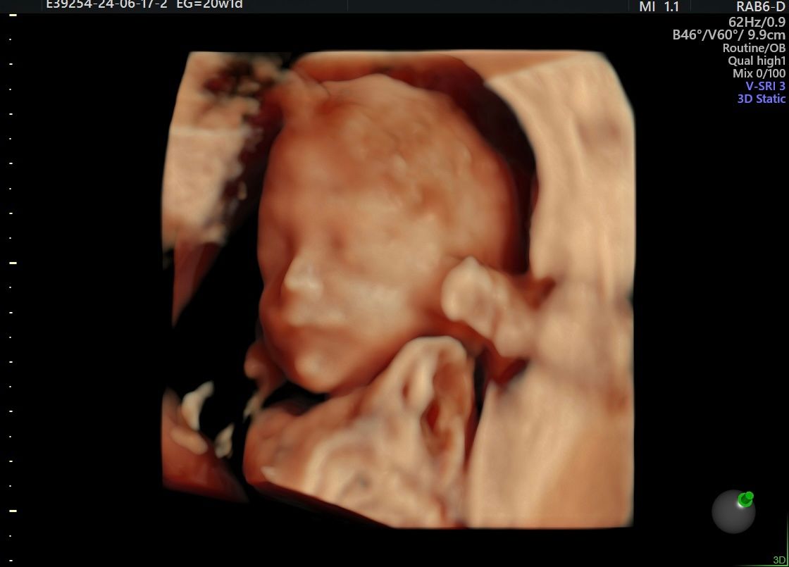 Erik Fernando González Martínez-4