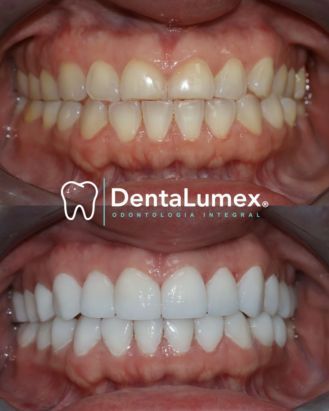 Nidya Irasema Gutierrez Garza-6