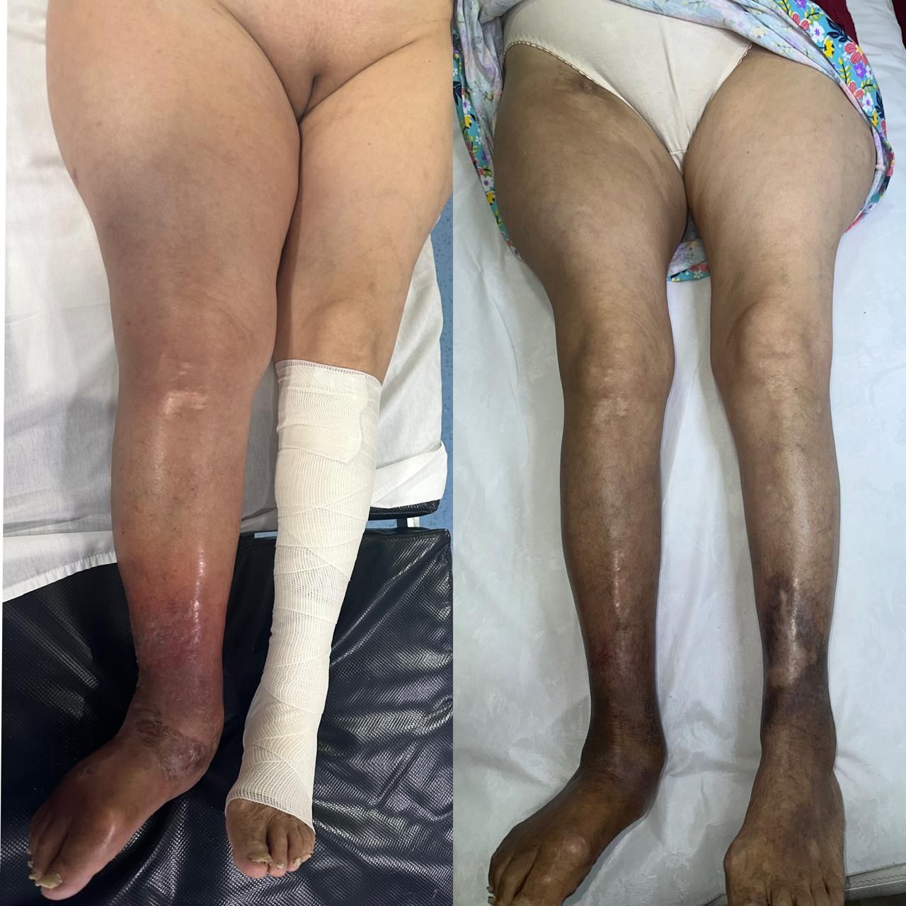 Jhonatan López González-28