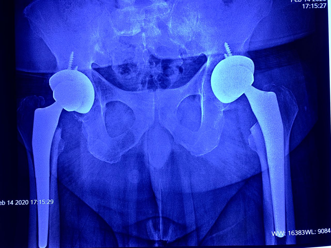 Luis Hernández Romero-4