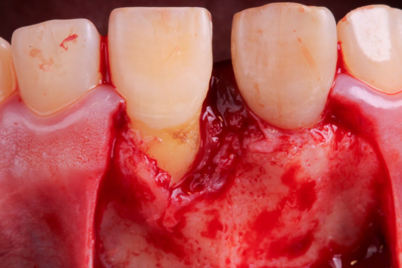 Hugo Enrique Aguilar Lamas-76