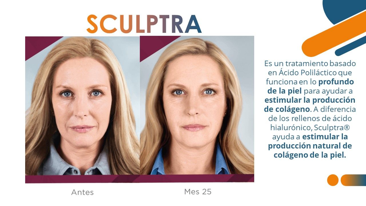 José Luis Muñoz Chapul-16