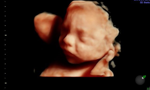 Elizabeth Valdez Lara-9