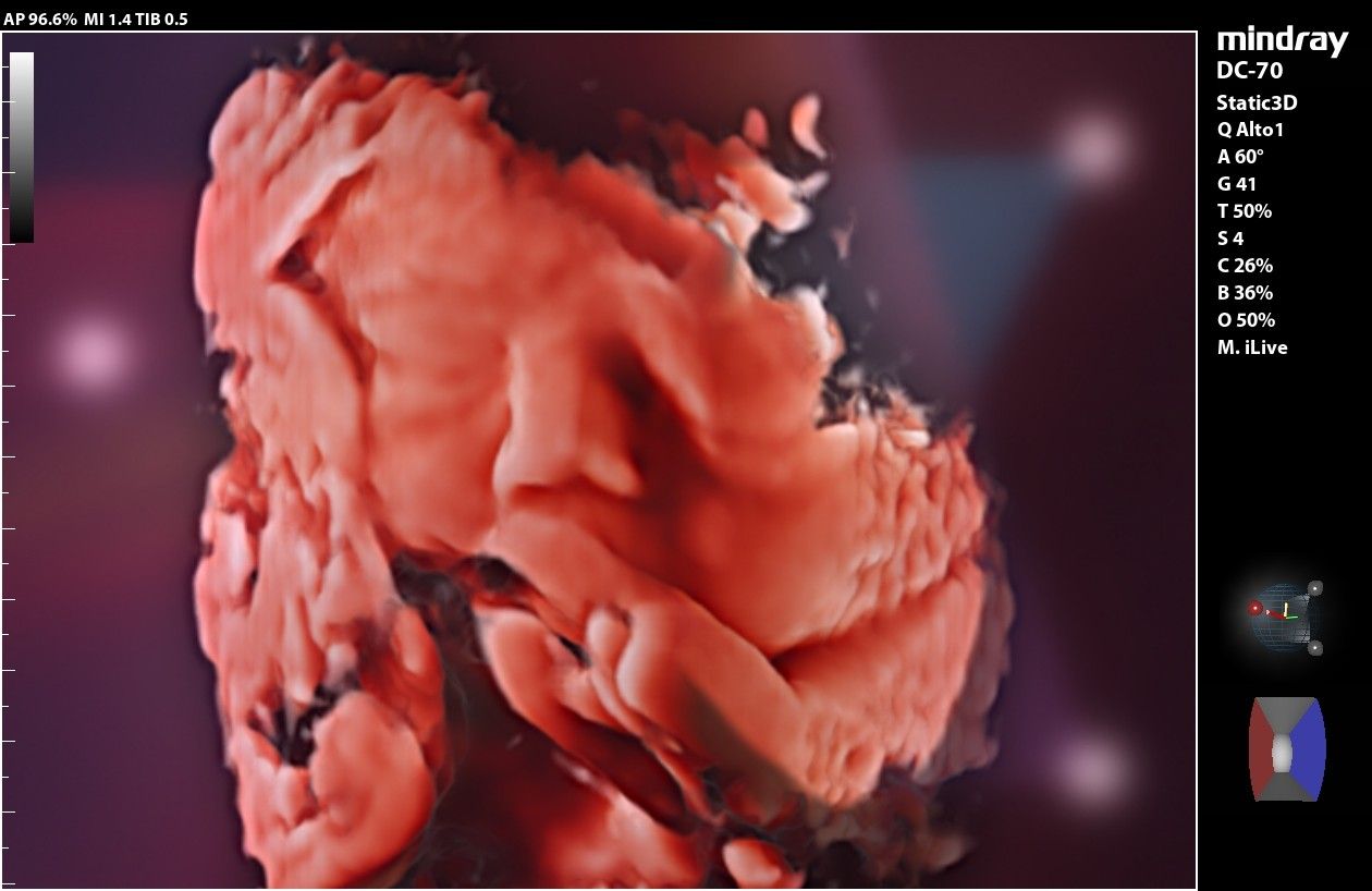 Joel Efraín Hernández Tapia-14