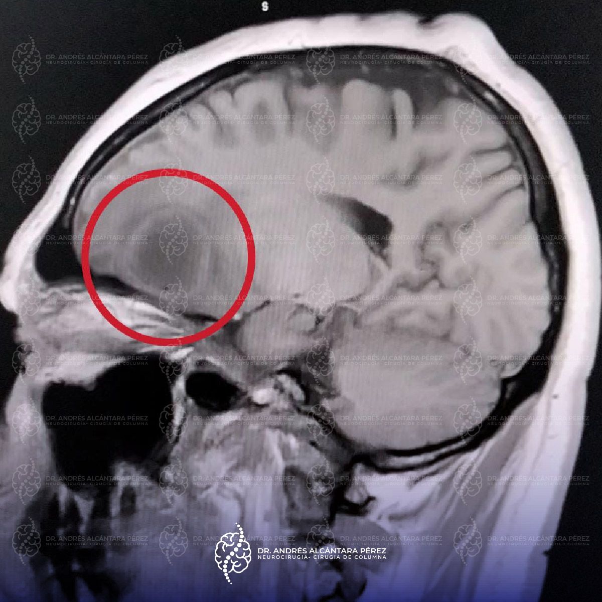 Andres Alcántara Pérez-4