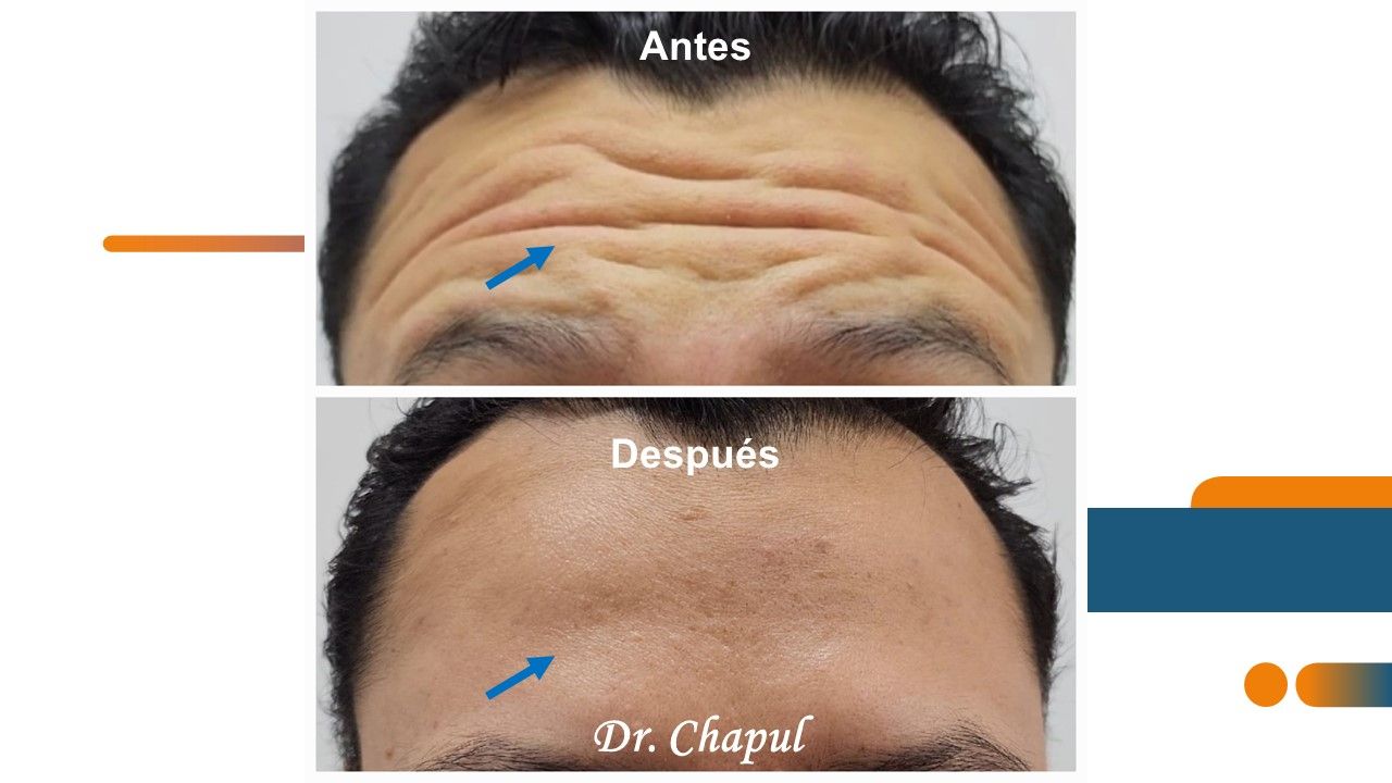 José Luis Muñoz Chapul-31