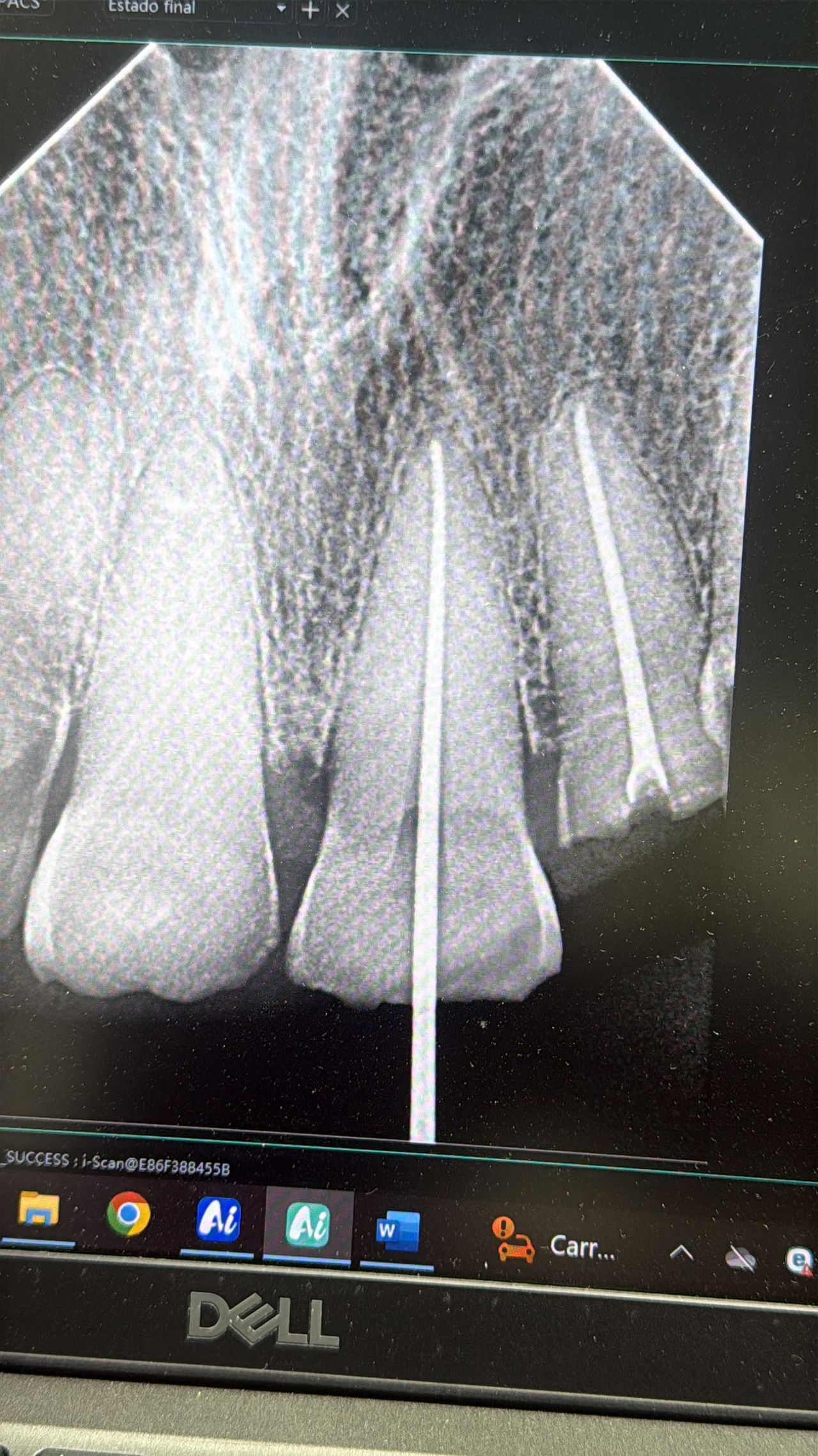 Jair Contreras García-63