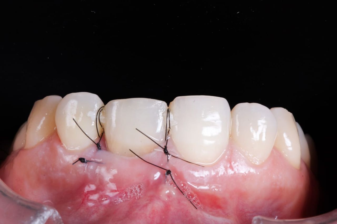 Hugo Enrique Aguilar Lamas-5