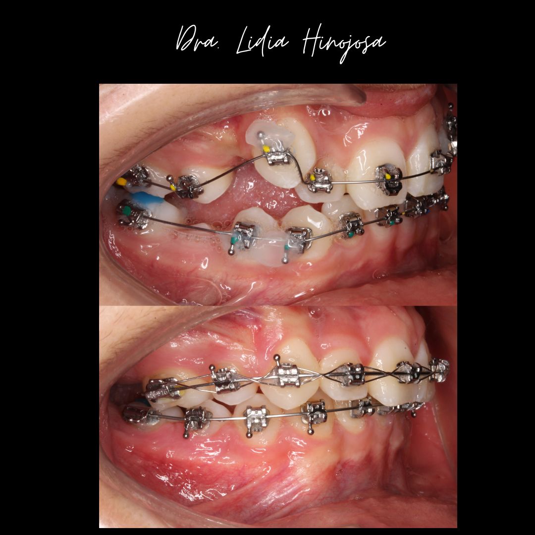 Lidia Abigail Hinojosa Arellanes-15