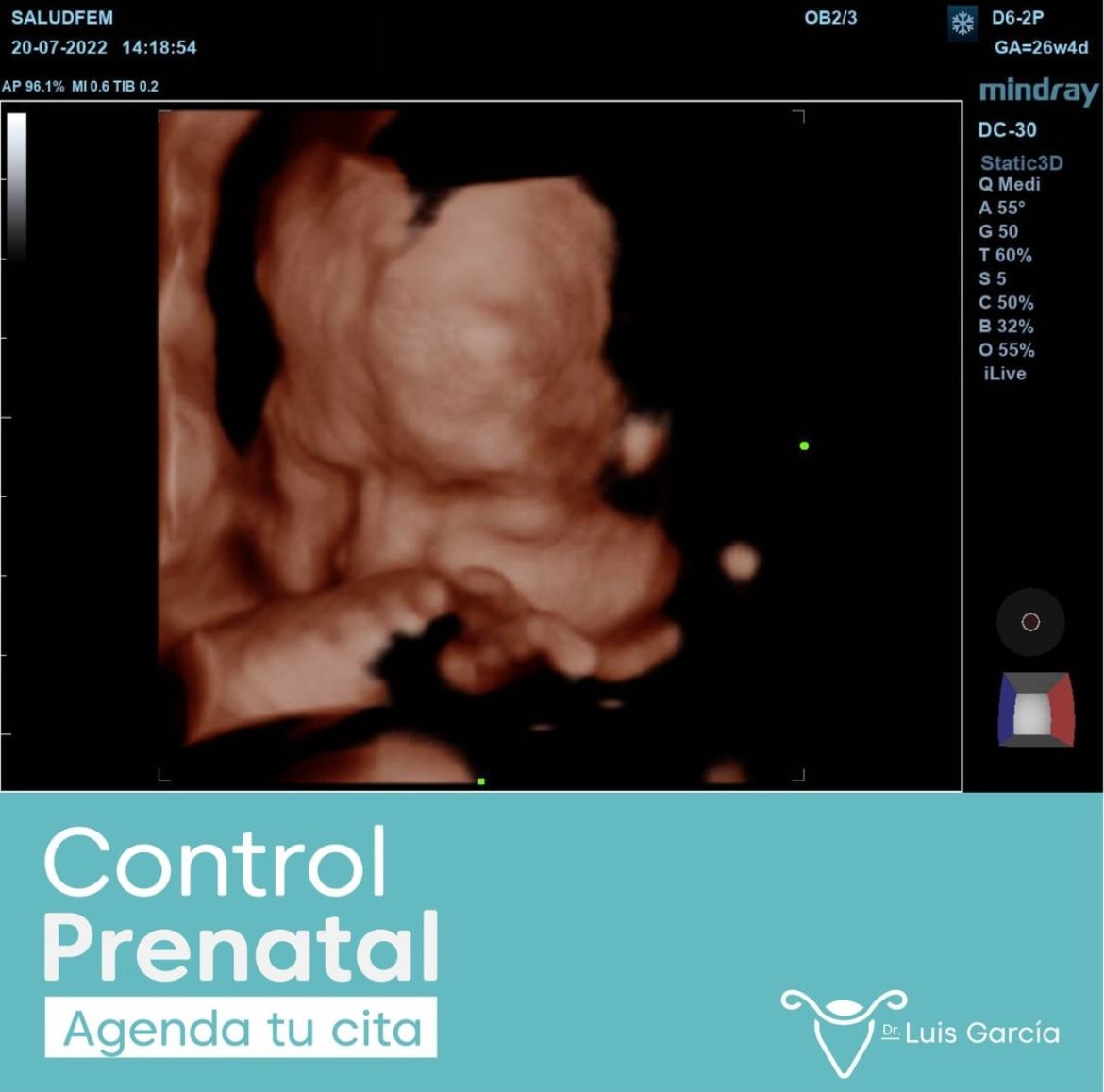 Luis Miguel García Romero-5