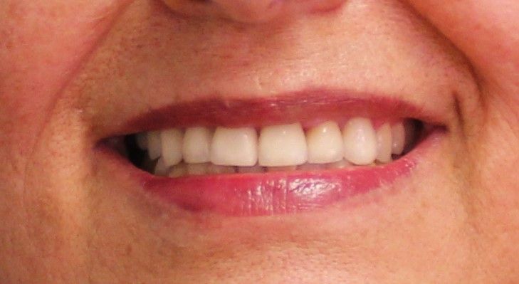 Esmeralda Candida Guerrero Pimentel-5