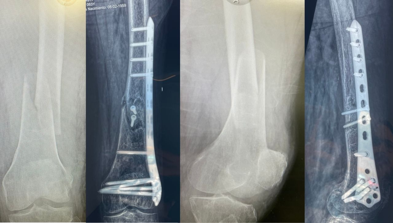 Diego Armando Contreras Rojas-18