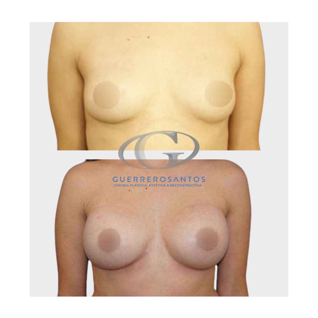 Fernando Guerrerosantos-0