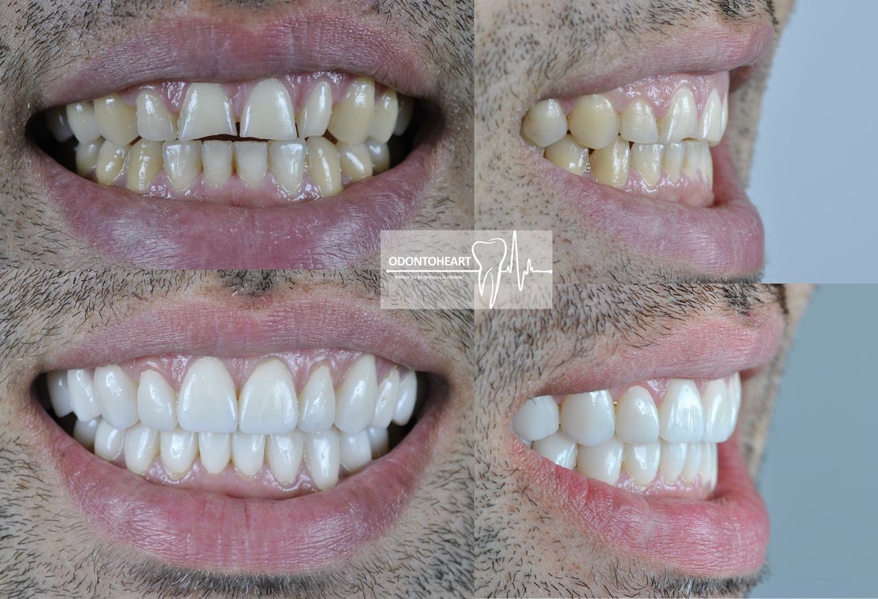 Alberto Companioni Bacha-20