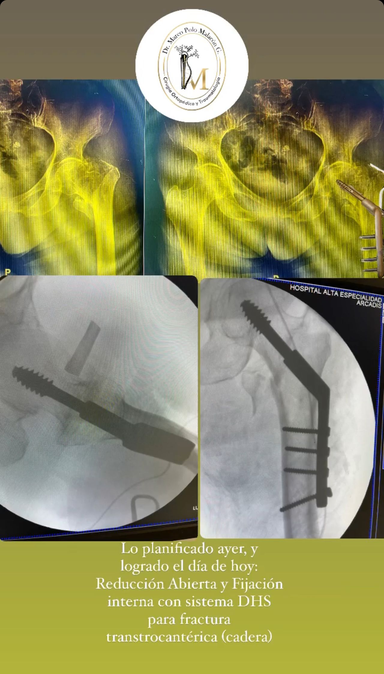 Marco Polo Malacón Gutiérrez-23