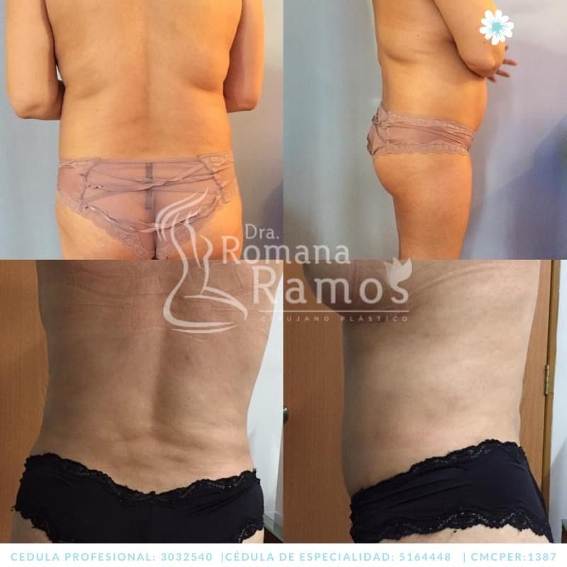 Romana Ramos Cárdenas-29