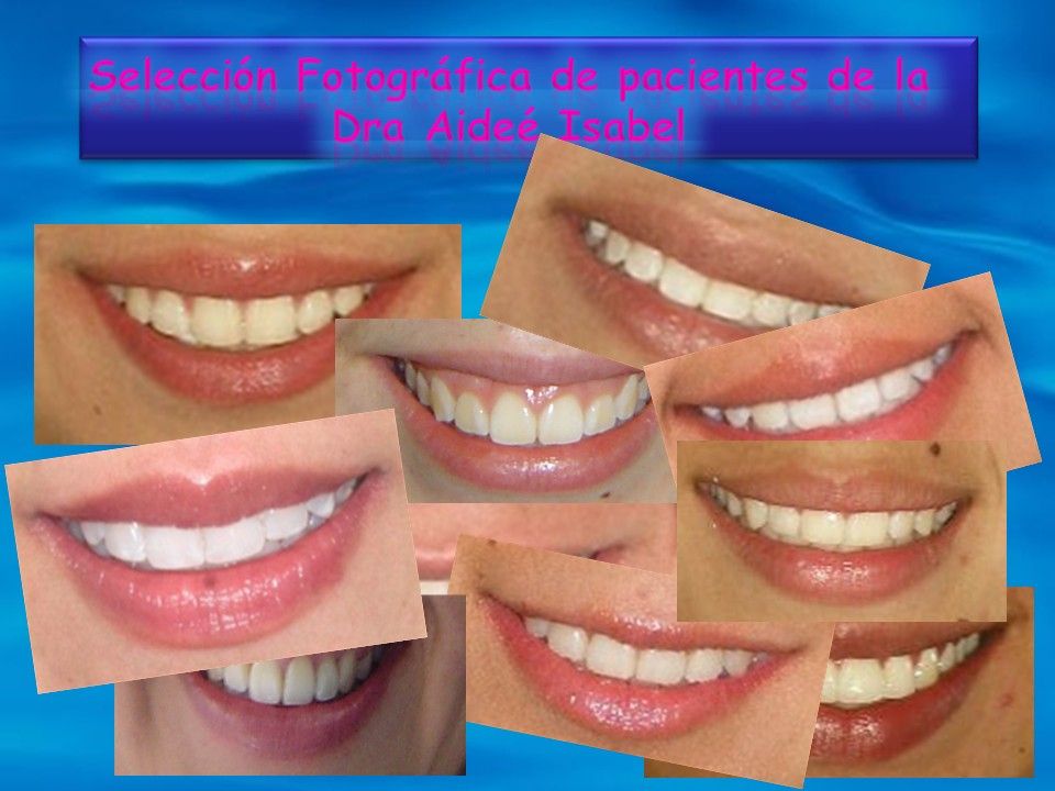 Aidee Isabel Agamez Pertuz-5