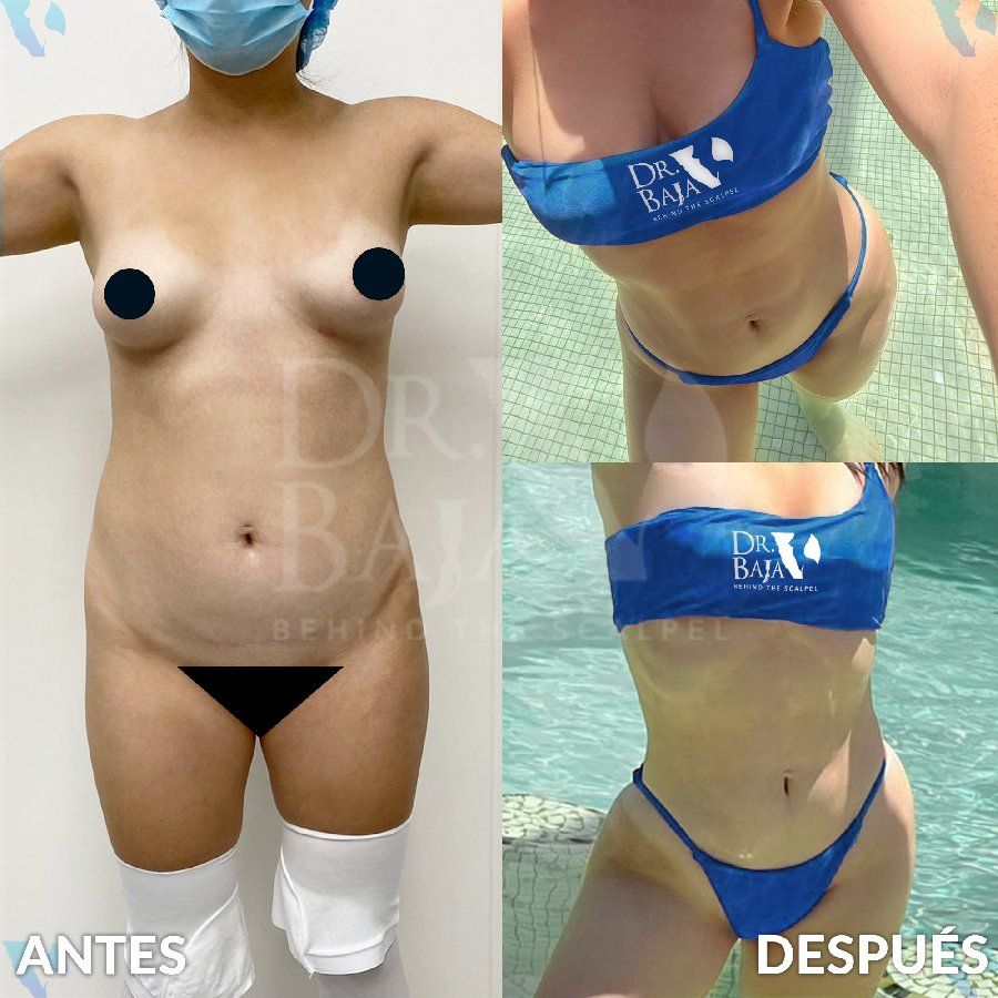 Renato Rodríguez Hirales-14