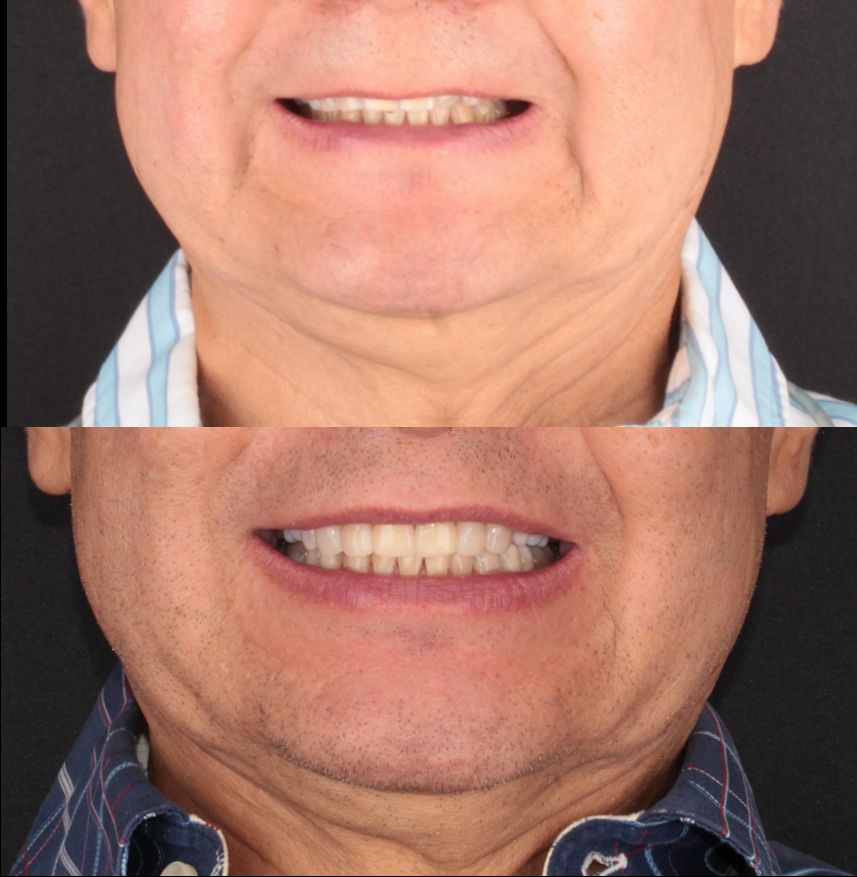 Aide Montserrat Orozco Gutierrez-27