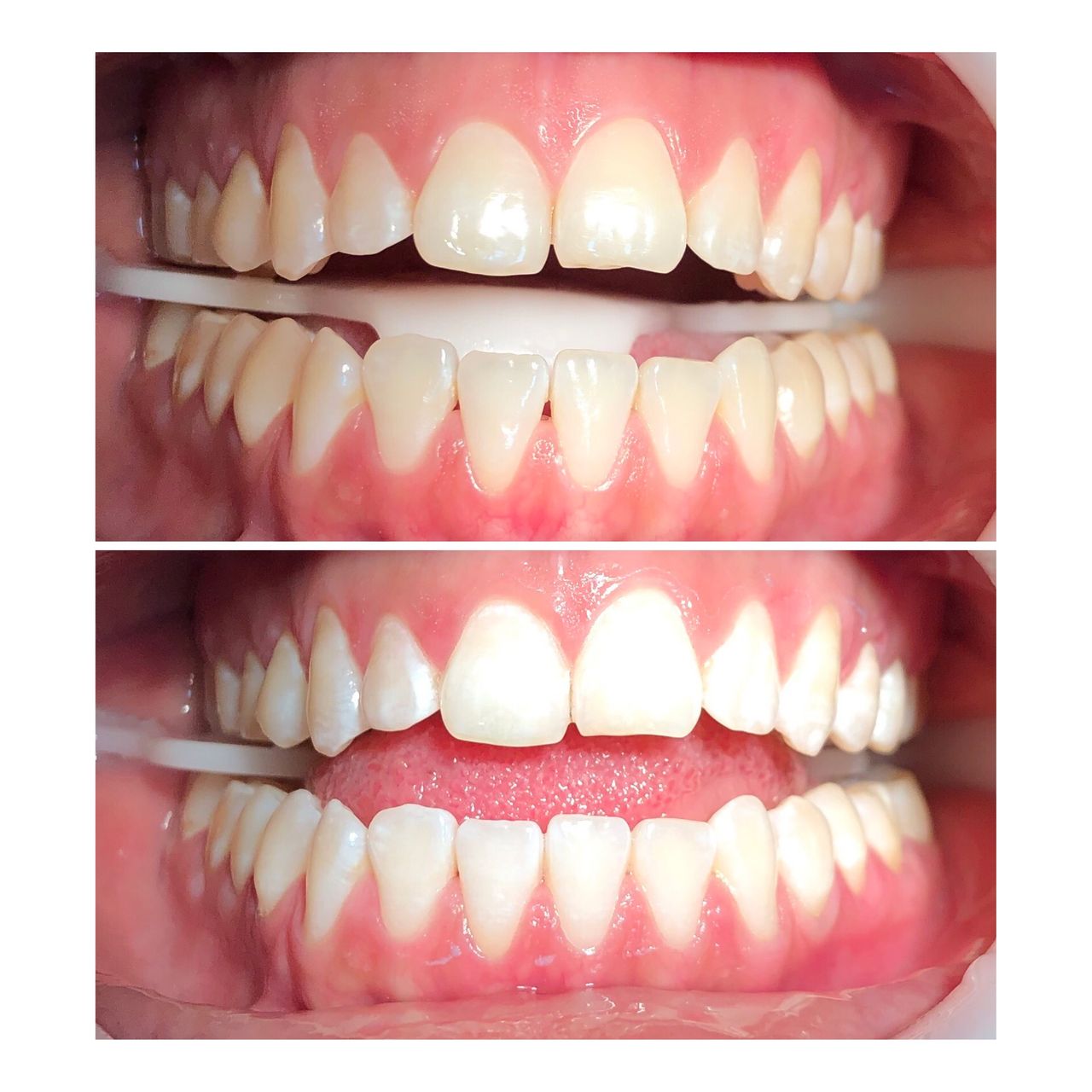 Zuriel Ayala Garcia-20