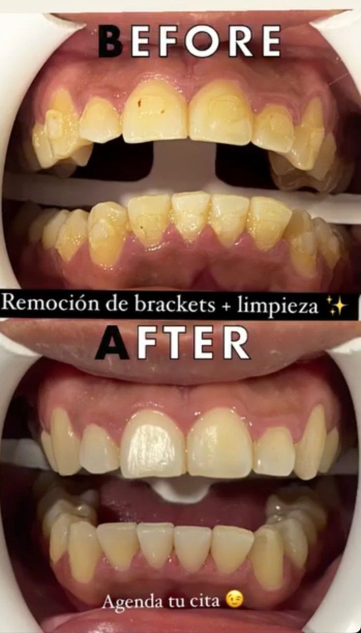 Anahí Orozco Vega-1