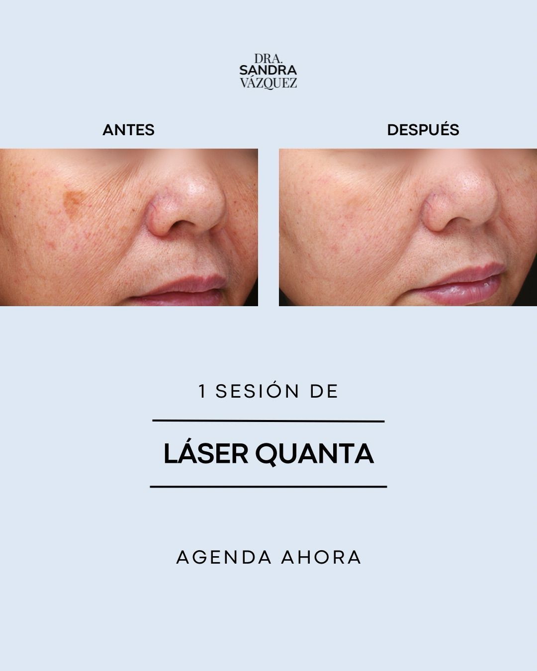 Sandra E. Vázquez Lares-8