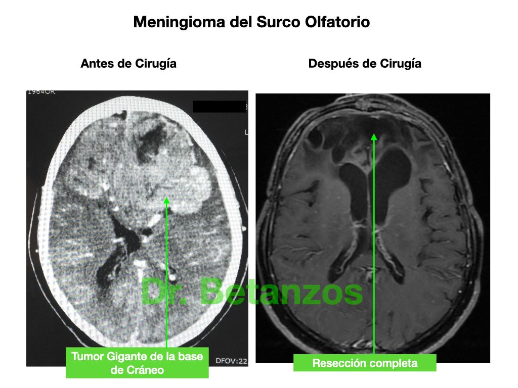 Aleixandre Betanzos Villegas-2