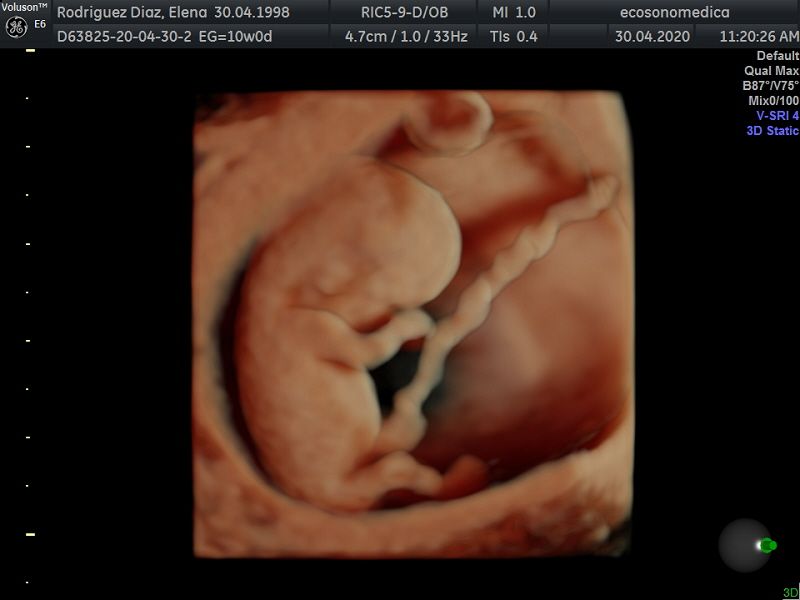 Héctor Bernardo Acevedo Manrique-3