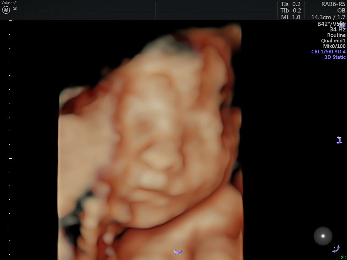 Griselda Reyes Torres-20