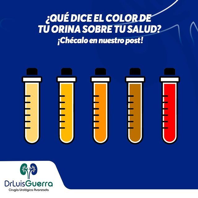 Luis Alberto Guerra Zepeda-160