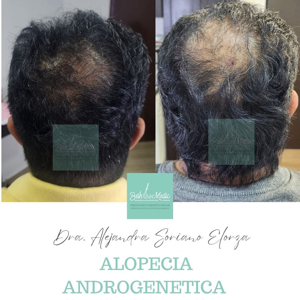 Alejandra Soriano Elorza-27