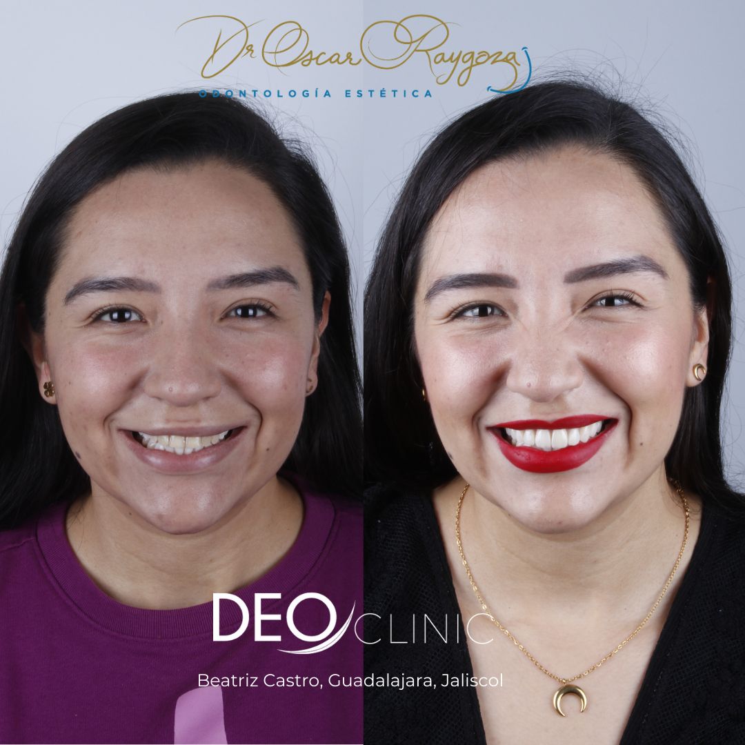 Oscar Raygoza Carrillo-37