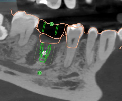 Alam Azael Arrazola González-21