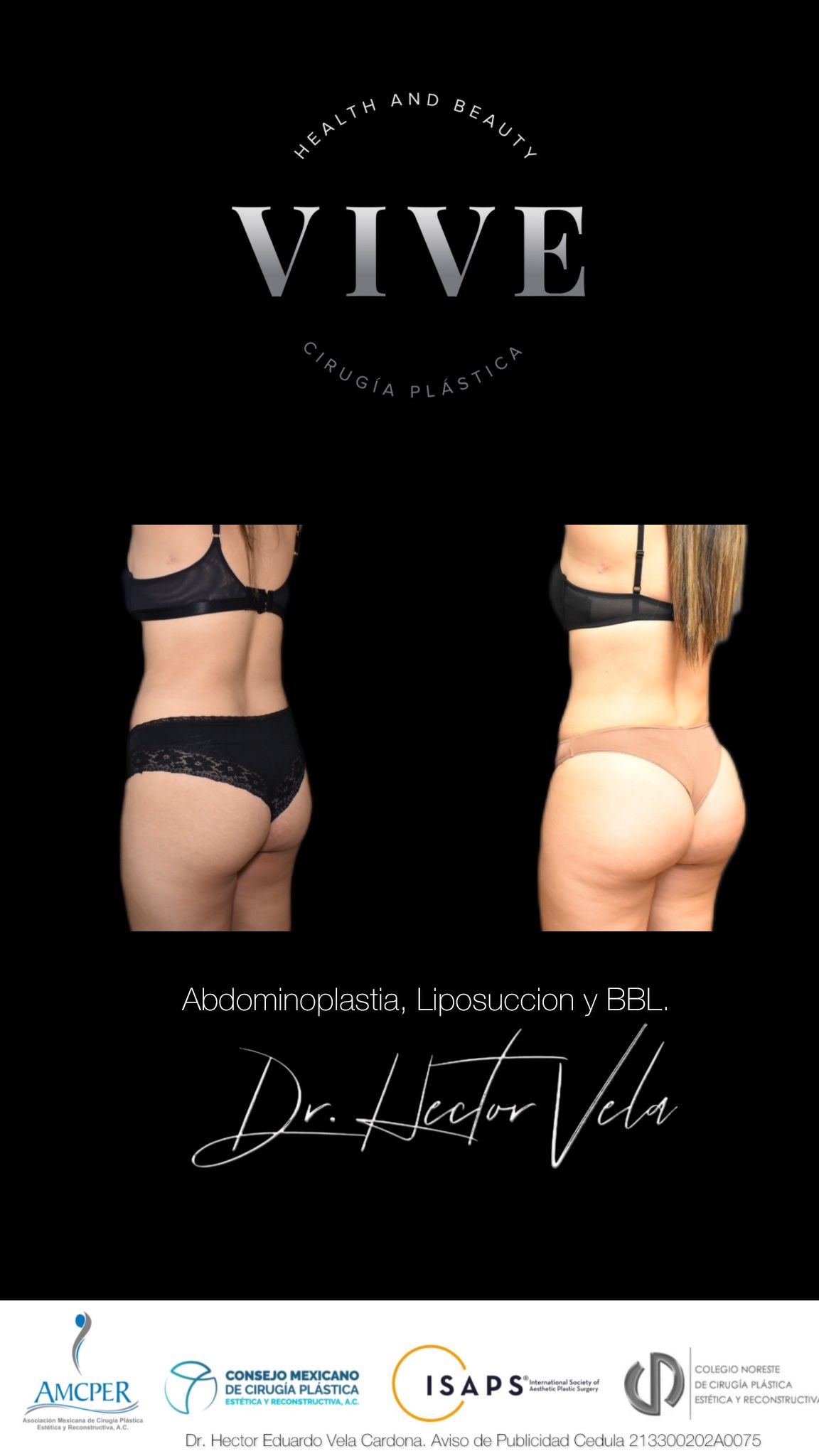 Héctor Eduardo Vela Cardona-31