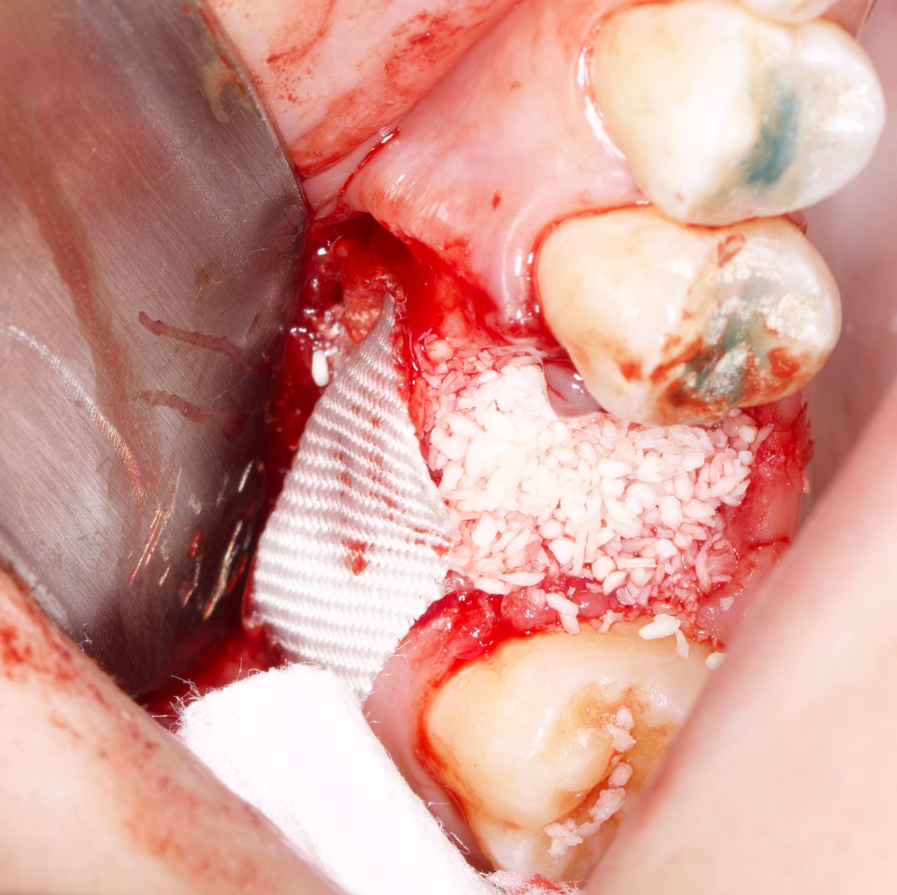 Luis Angel Carranza Resendez-12