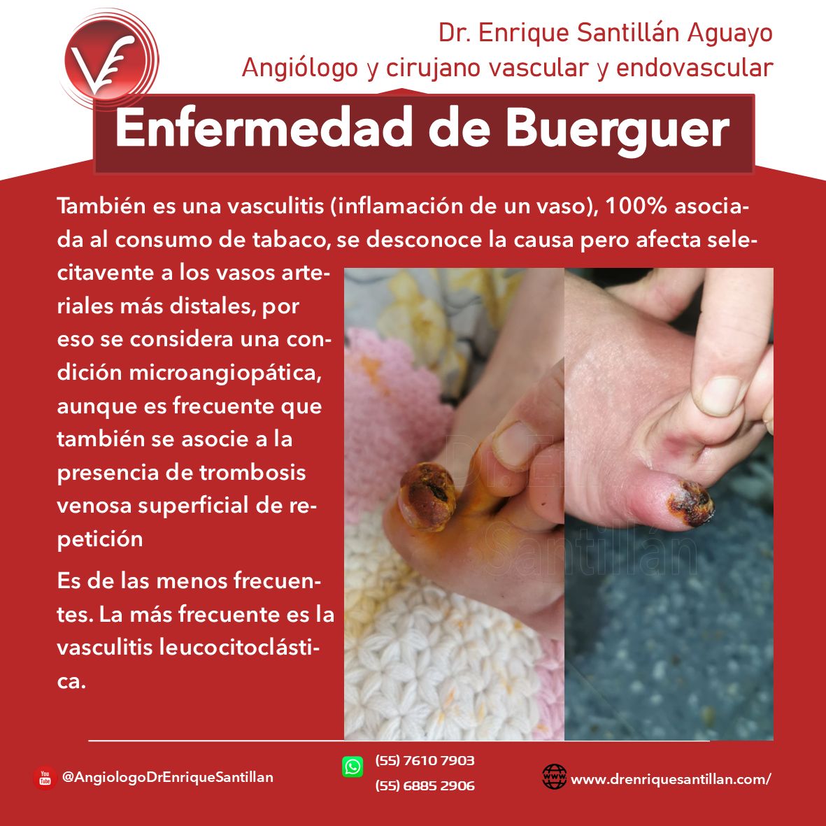 Enrique Santillán Aguayo-5