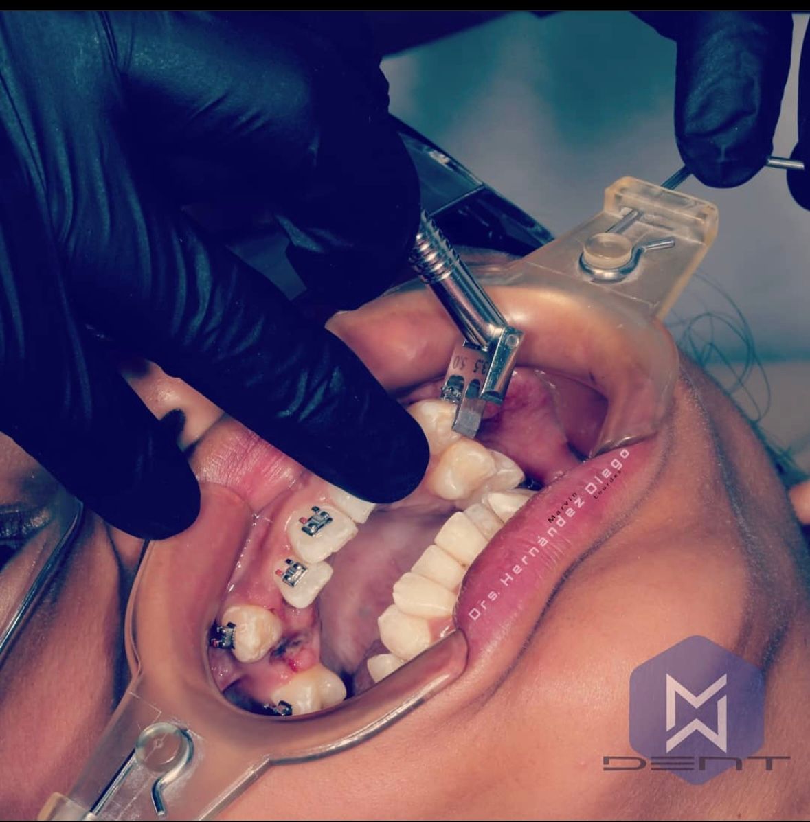 Marvin Adair Hernández Álvarez-45