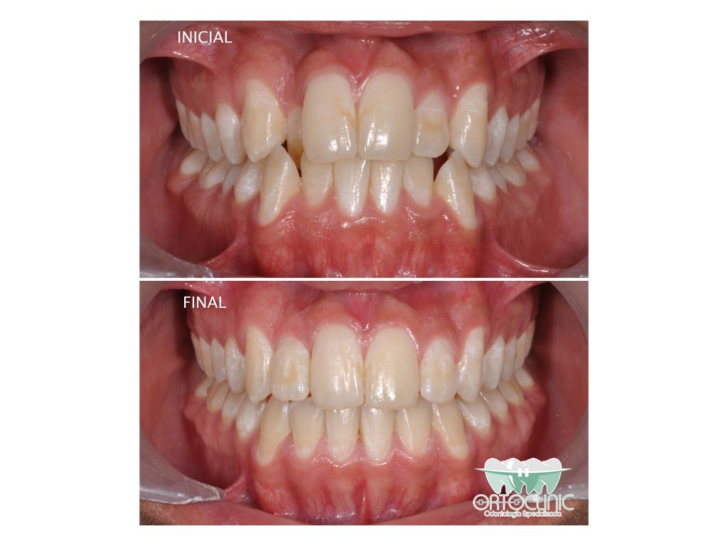 Alerí Morales Rodríguez-7