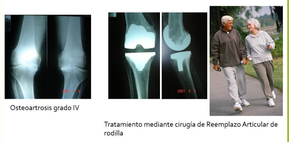 Rubén Rodriguez Acosta-9