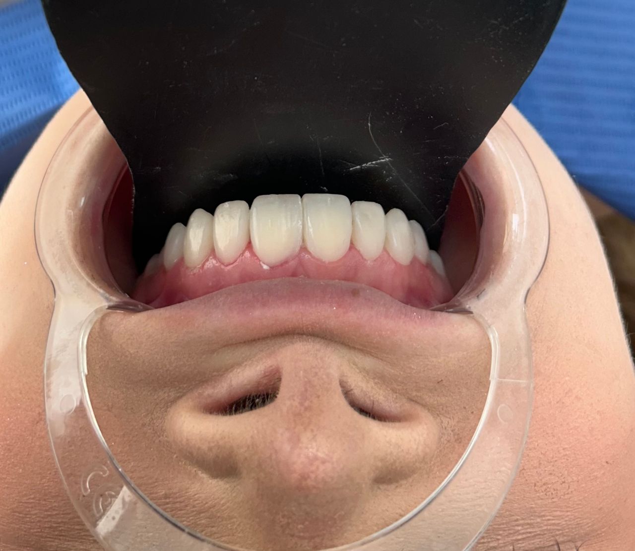 Sergio Bencomo Angulo-0