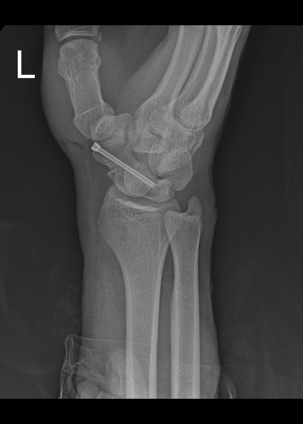 Carlos Humberto Vera Torres-1