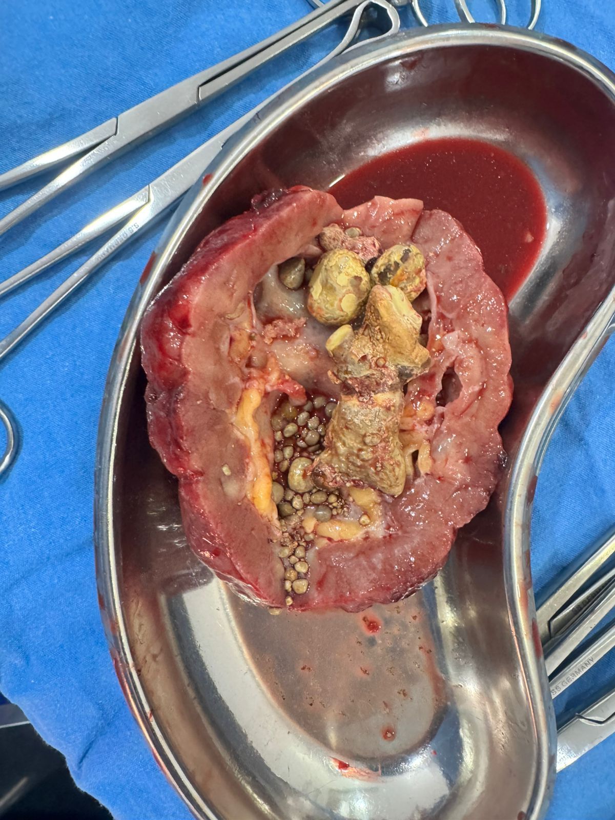 Gabriel Gonzalez Sosa-12