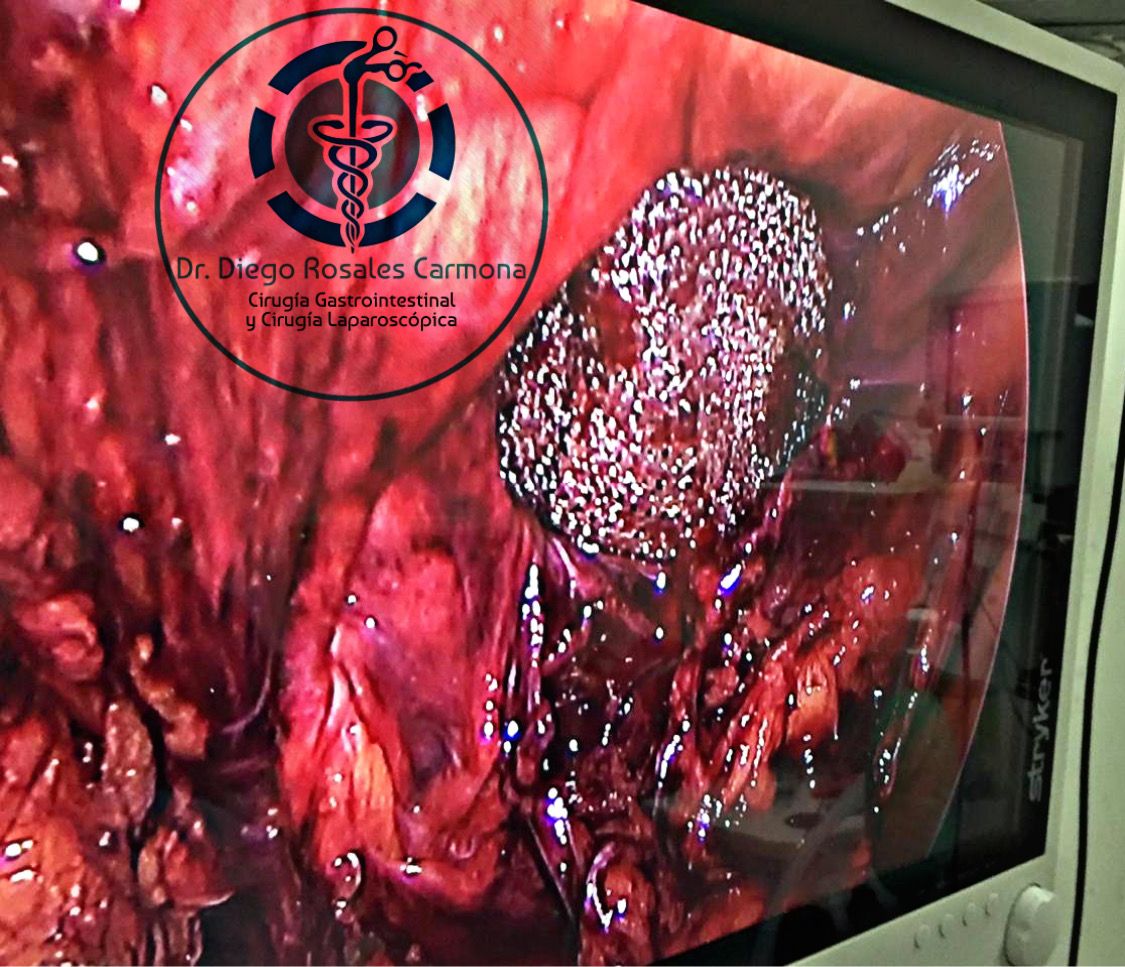 Diego Edwuin Rosales Carmona-12