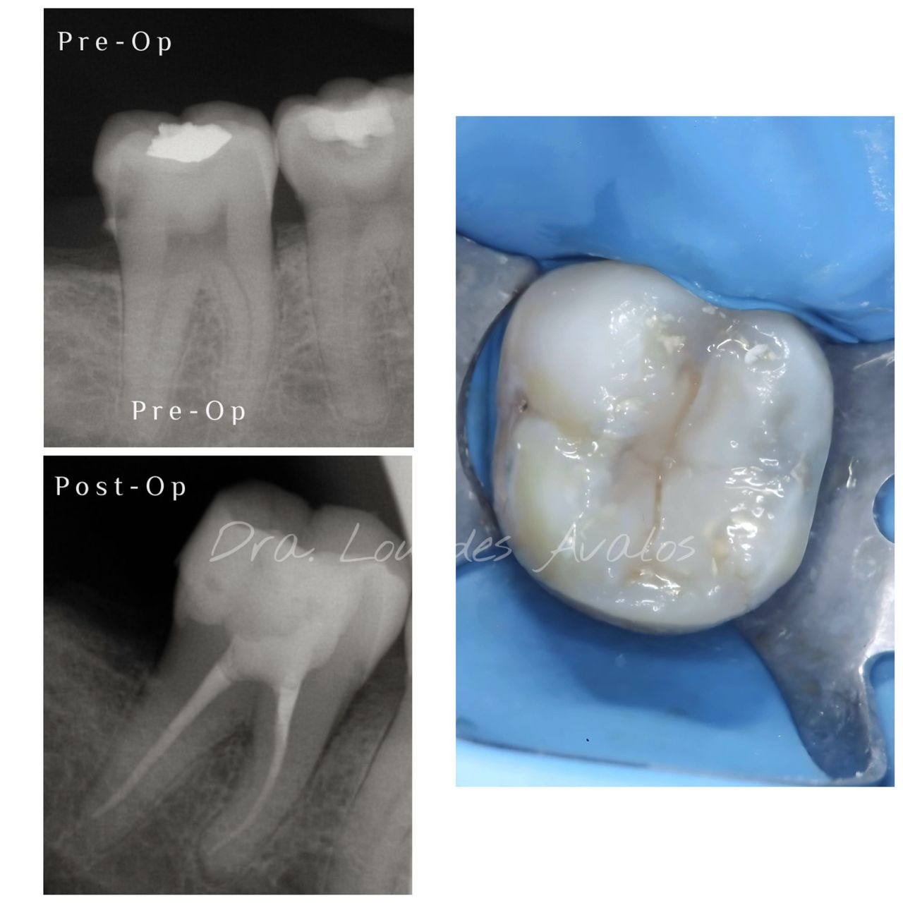Lourdes Avalos Piña-2
