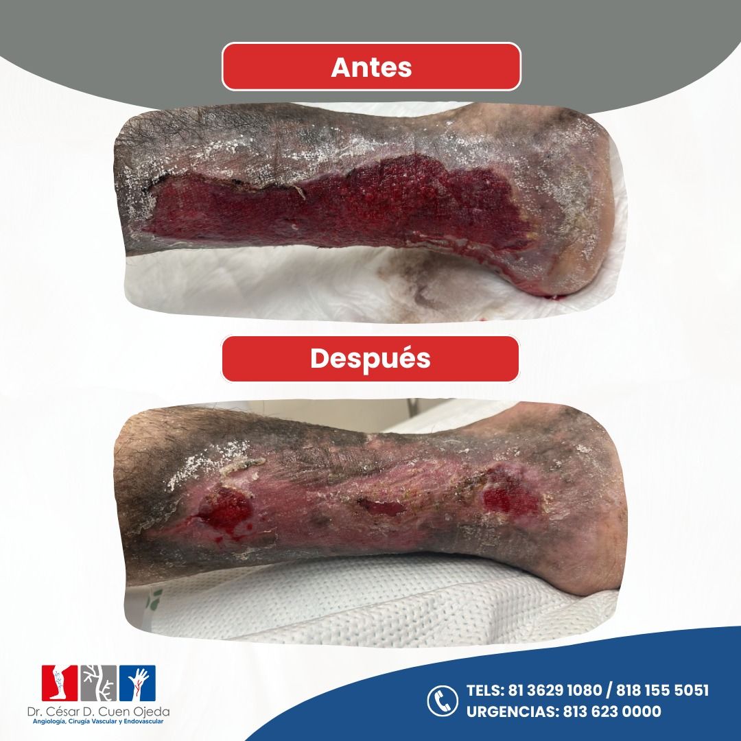 César Daniel Cuen Ojeda-8