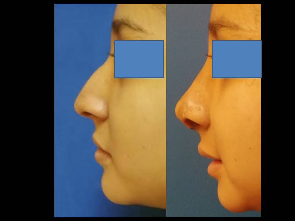 María Isabel Pérez López Burkle-1