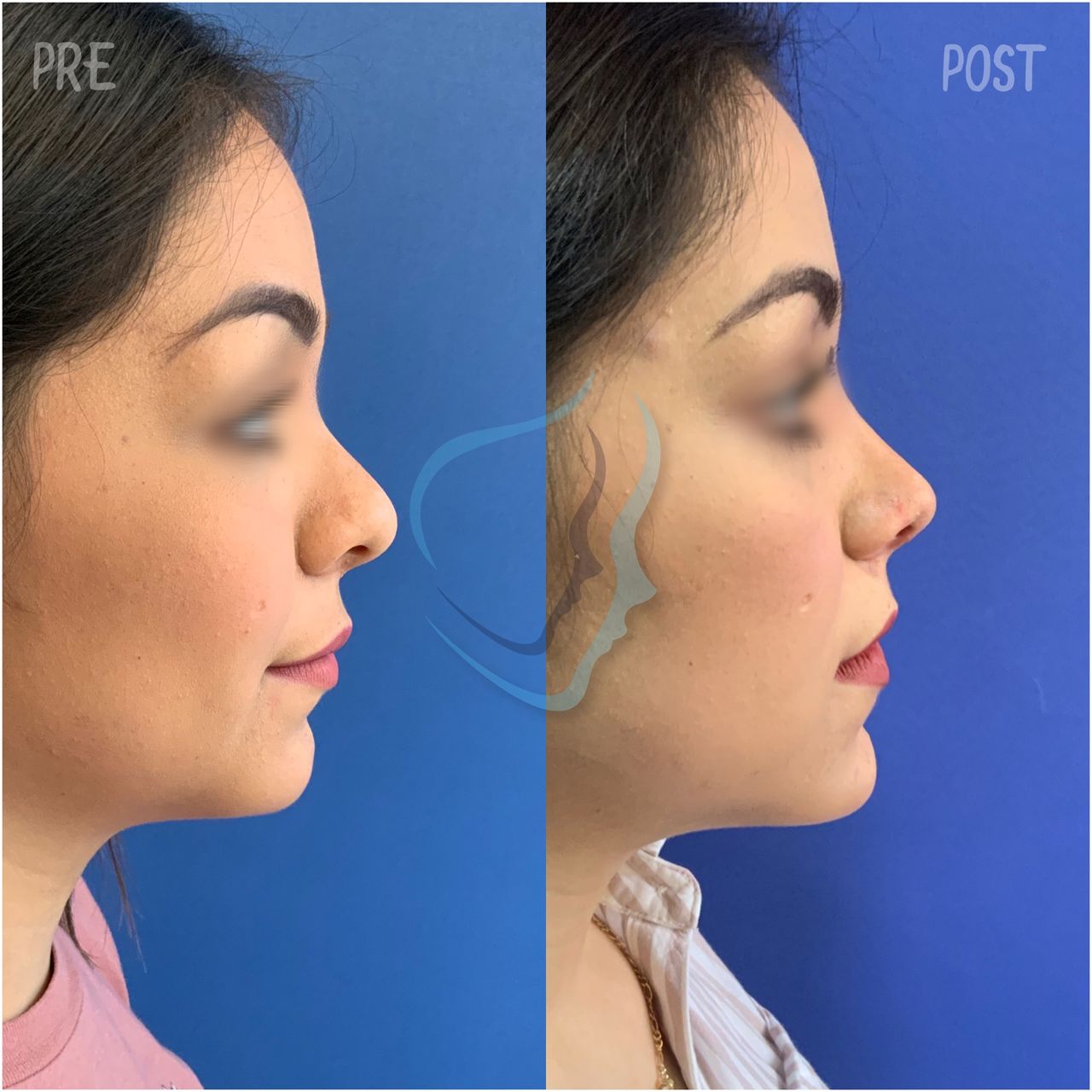 Giuseppe Tanzillo-73