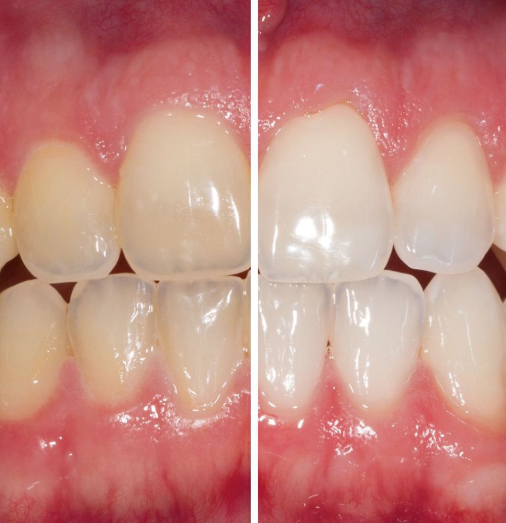 Esmeralda Candida Guerrero Pimentel-26