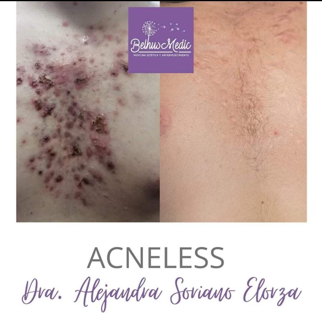 Alejandra Soriano Elorza-33